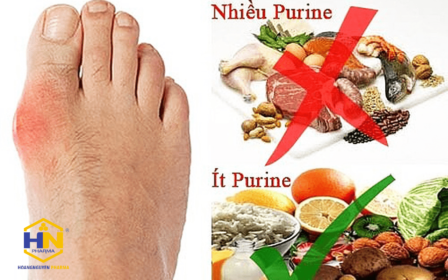 Chế Độ Ăn Tốt Nhất Cho Bệnh Gout3