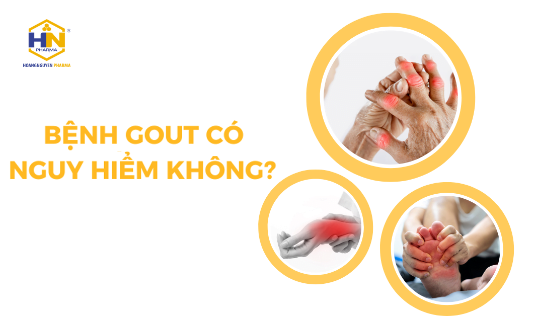 bệnh gout có nguy hiểm không
