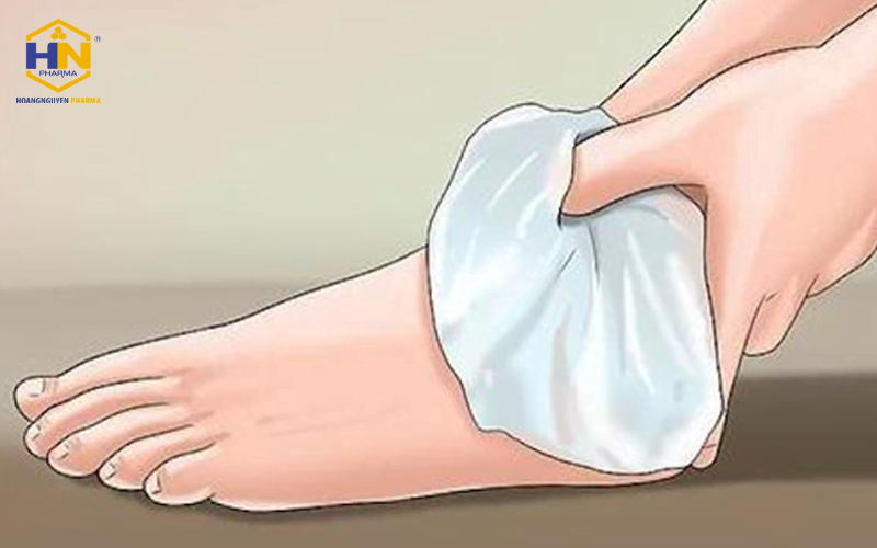 Bị gout có nên chườm đá? Phân tích toàn diện từ chuyên gia